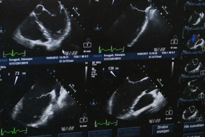 Decesul fetal cauză - Cauza decesului fetal descoperită de oamenii de știință: Află mai multe!