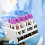 Mielom multiplu studiu - Mielomul multiplu: Cum diferă evoluția între bărbați și femei, arată un studiu surprezător