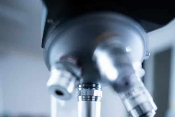 Analiza urinei cancer vezică - Analiza urinei: O nouă speranță în lupta cu cancerul de vezică urinară!