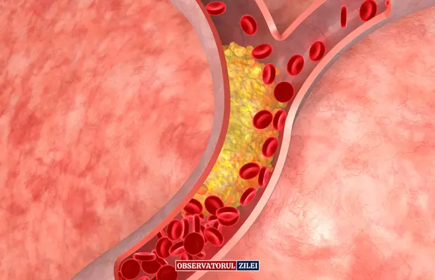 Nou inhibitor PCSK9: Colesterolul LDL scade cu aproape 60%! 1 Colesterol LDL inhibitor PCSK9 - Nou inhibitor PCSK9: Colesterolul LDL scade cu aproape 60%!